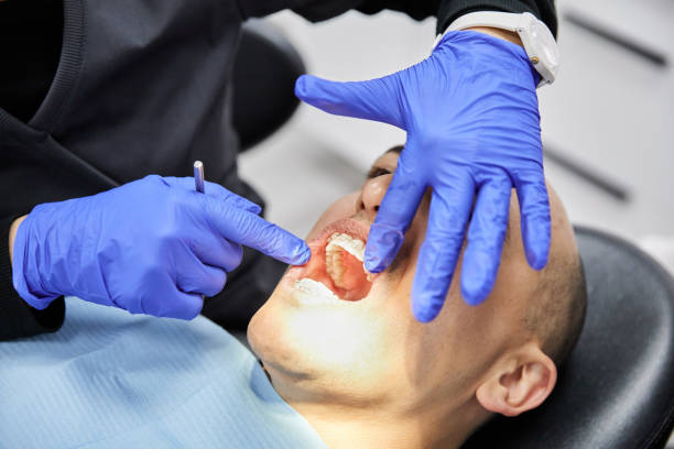 Best Teeth Whitening  in Redwood, OR